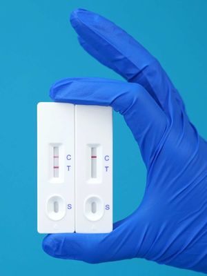 Quick and Easy Influenza Ag A Test Nasopharyngeal Swab Results in 5min Suitable for 4-30C Environment